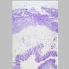 Intestino grueso SF 01.jpg